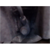 PIVOT AVANT DROIT FORD FIESTA 05-08